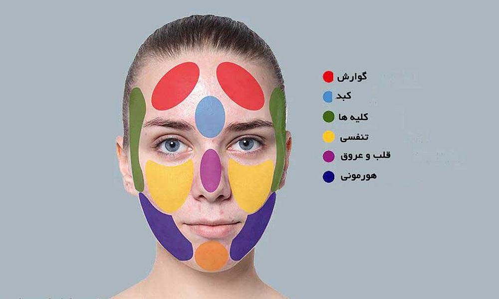 جوش صورت